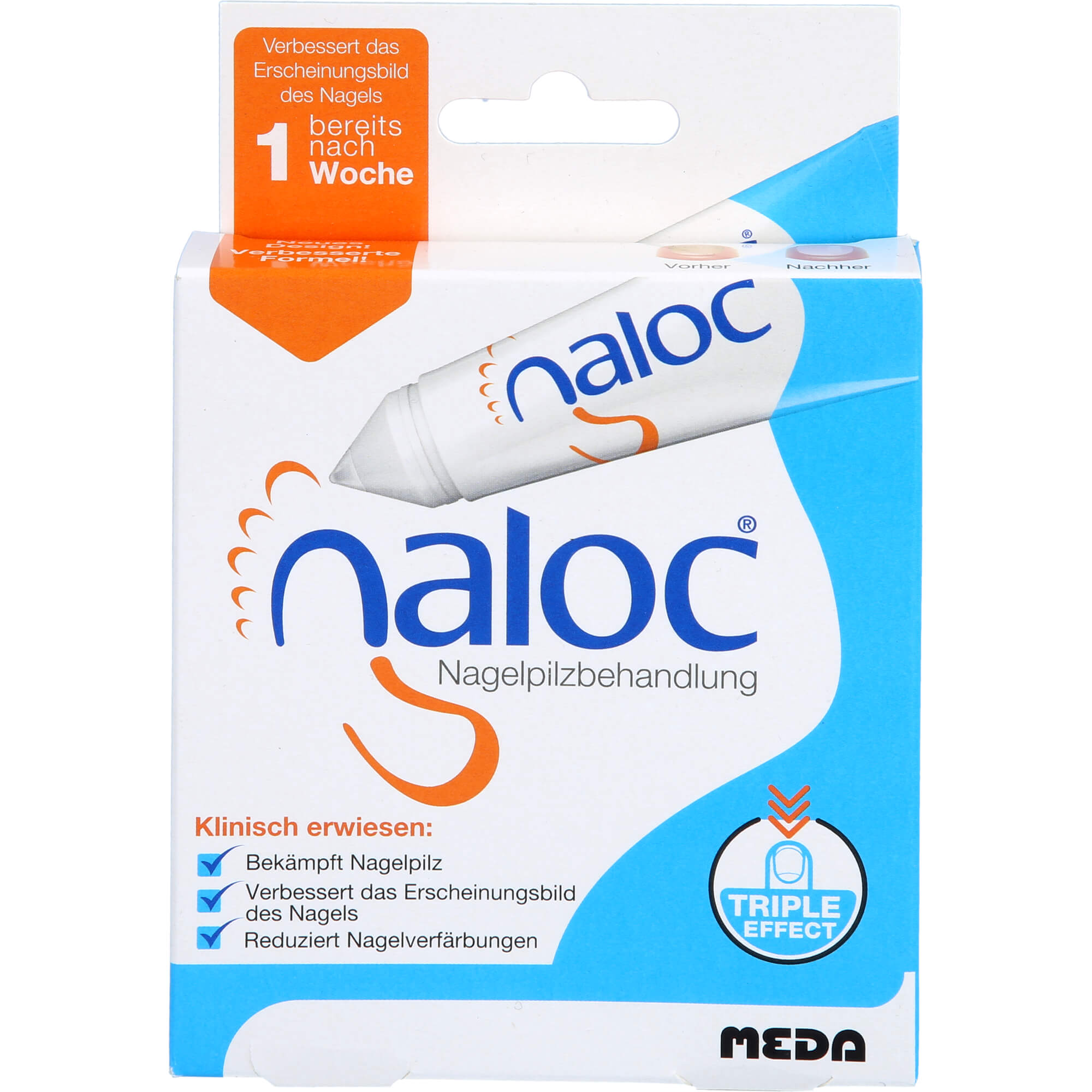 NALOC-Becur Lösung